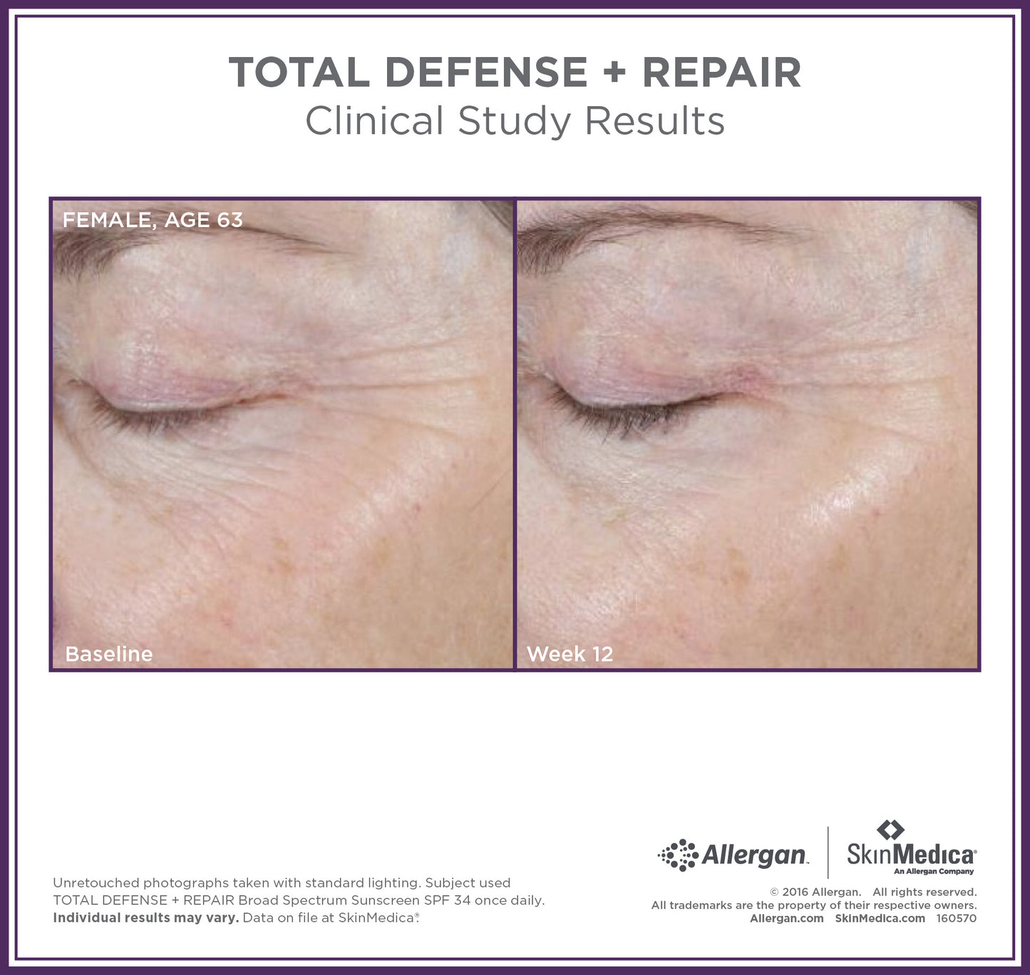 Total Defense + Repair Broad Spectrum SPF 34 / PA ++++ Sunscreen | SkinMedica