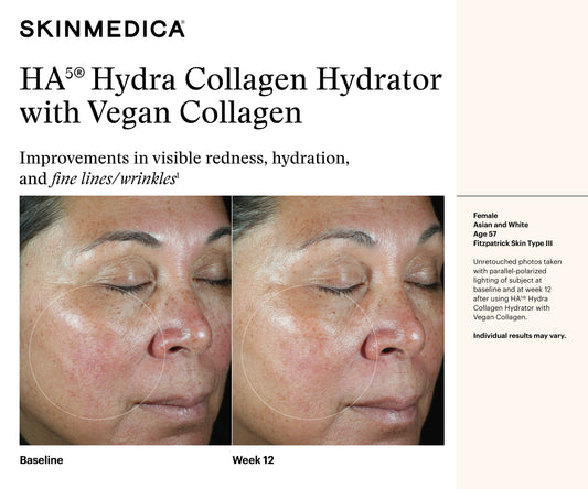 HA5 Hydra Collagen Hydrator with Vegan Collagen | SkinMedica