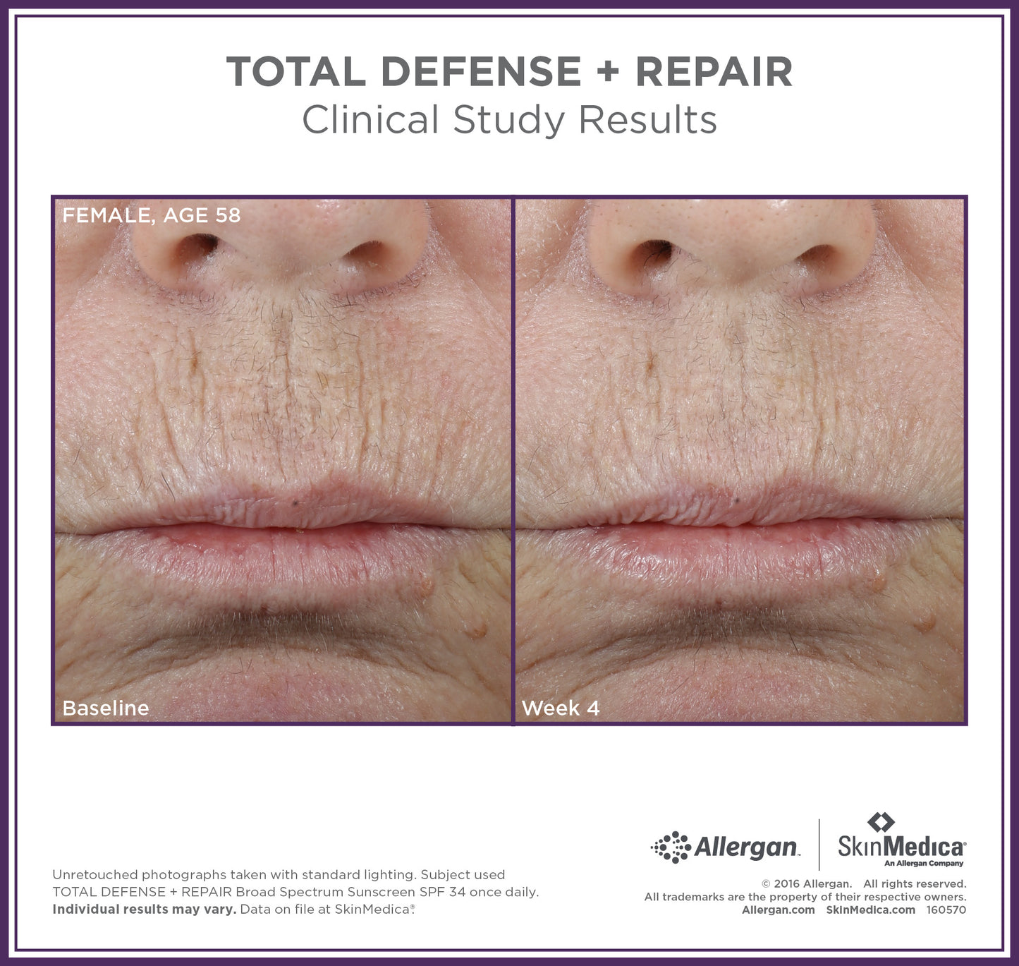Total Defense + Repair Broad Spectrum SPF 34 / PA ++++ Sunscreen | SkinMedica