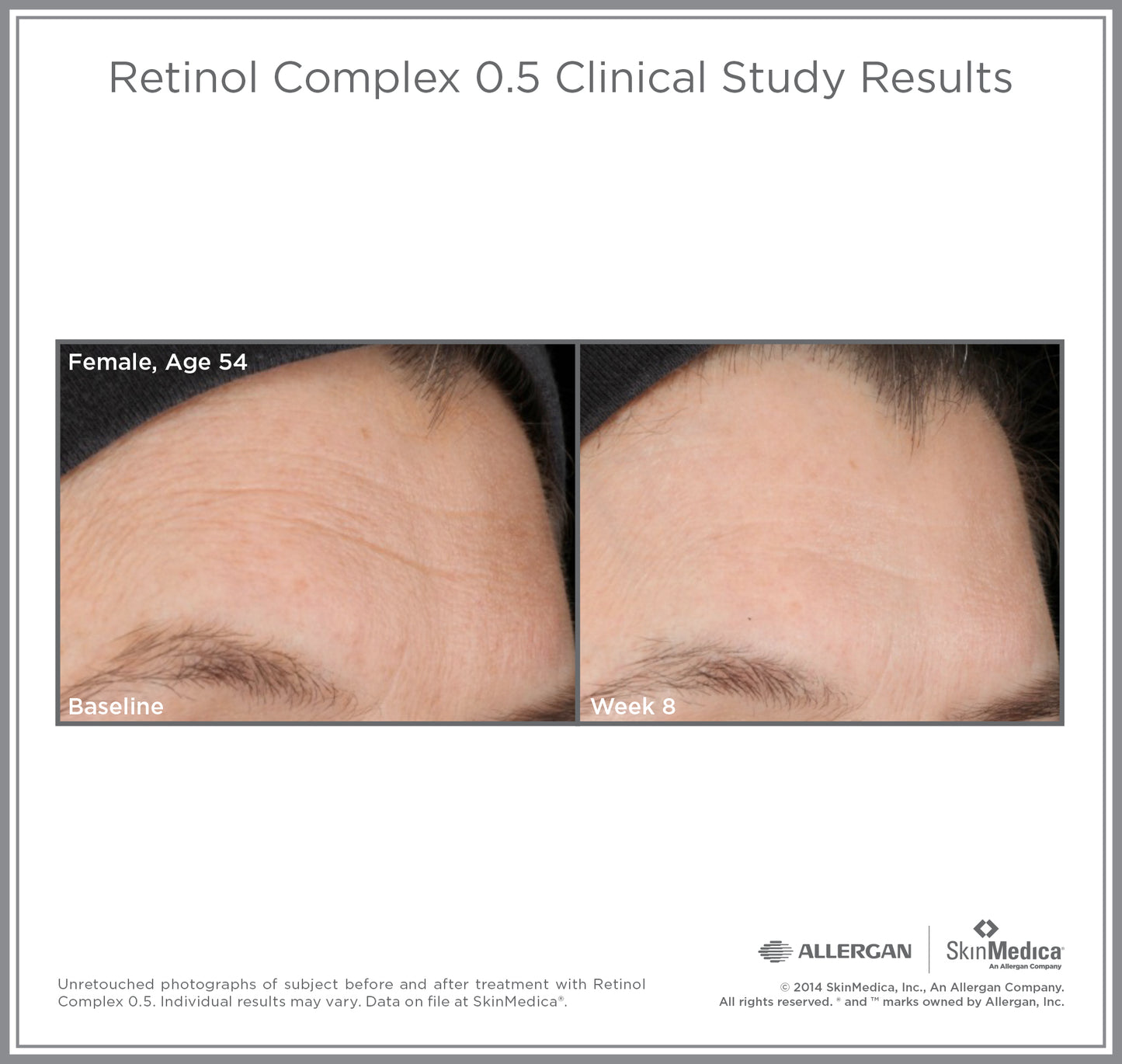 Retinol Complex 0.5 | SkinMedica