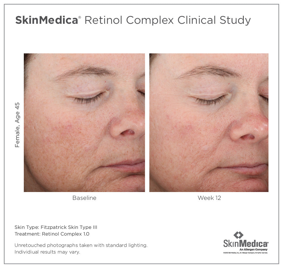 Retinol Complex 1.0 | SkinMedica