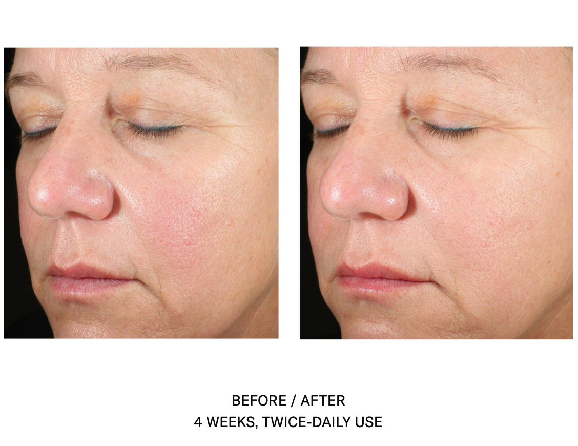 Alto Advanced Defense and Repair Serum | SkinBetter Science