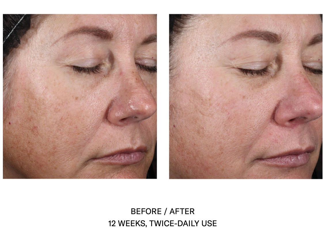 Alto Advanced Defense and Repair Serum | SkinBetter Science