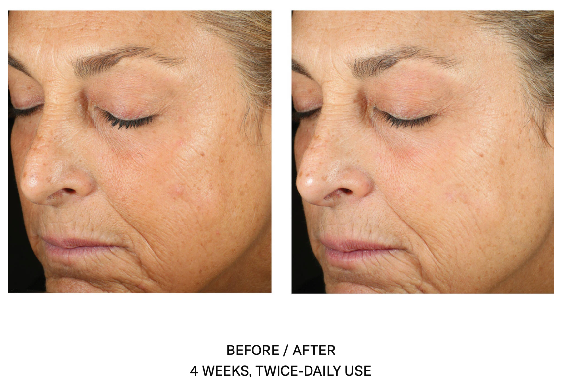 Alto Advanced Defense and Repair Serum | SkinBetter Science