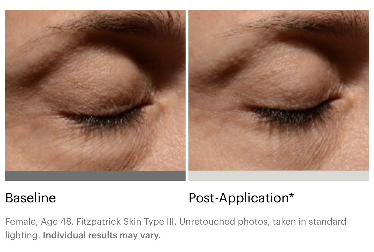Instant Bright Eye Cream | SkinMedica