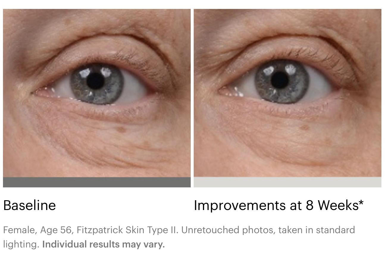 Instant Bright Eye Cream | SkinMedica