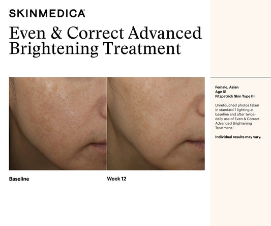 Even & Correct Advanced Brightening Treatment | SkinMedica