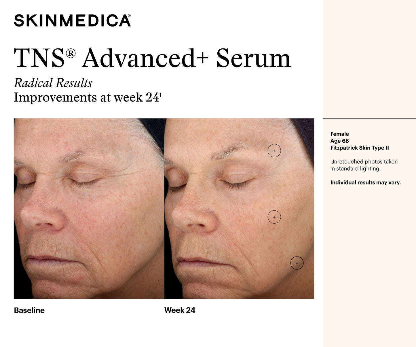 TNS Advanced+ Serum | SkinMedica