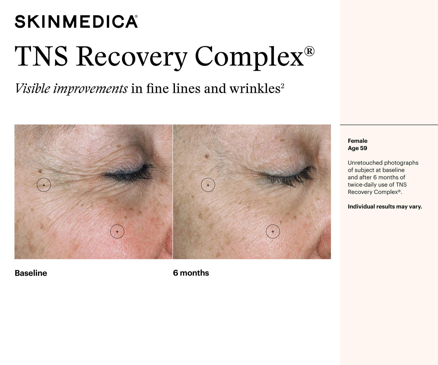 TNS Recovery Complex | SkinMedica