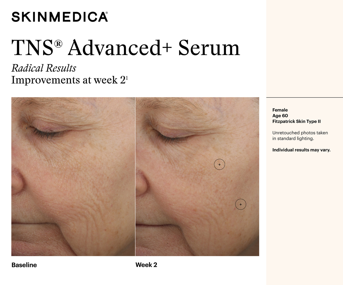 TNS Advanced+ Serum | SkinMedica