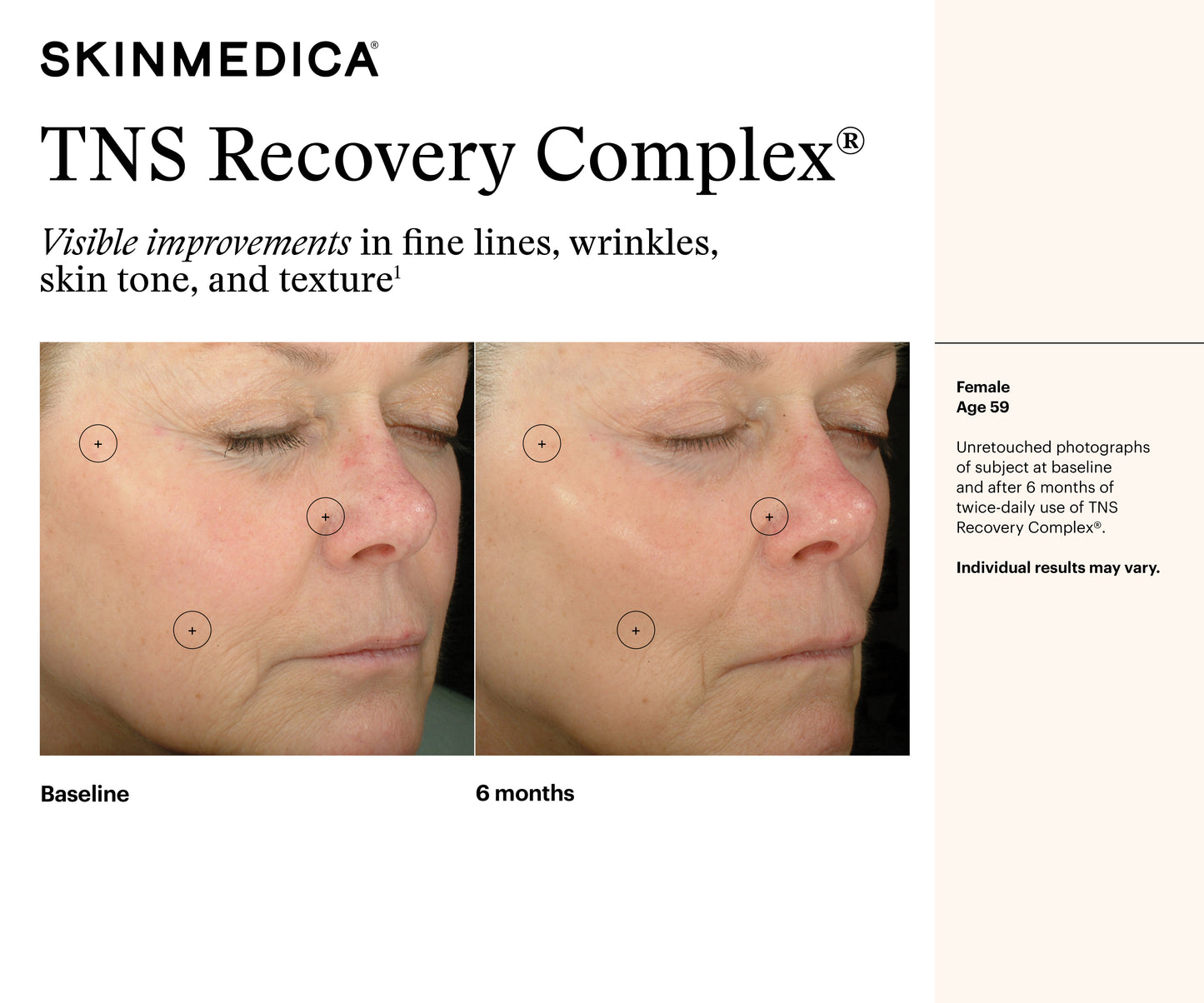TNS Recovery Complex | SkinMedica