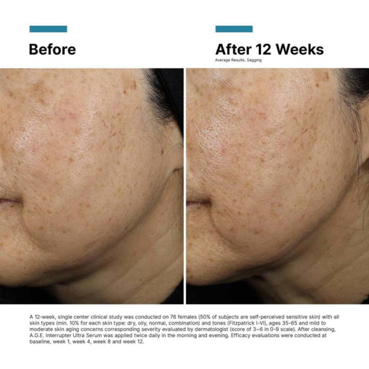 A.G.E Interrupter Ultra Serum | SkinCeuticals