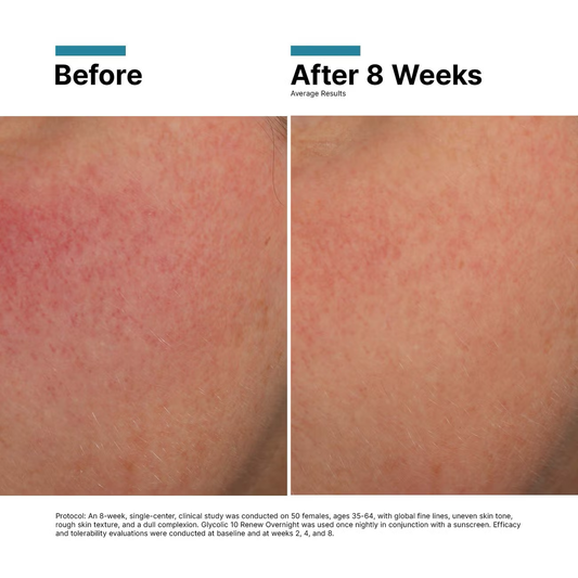Glycolic 10 Renew Overnight | SkinCeuticals