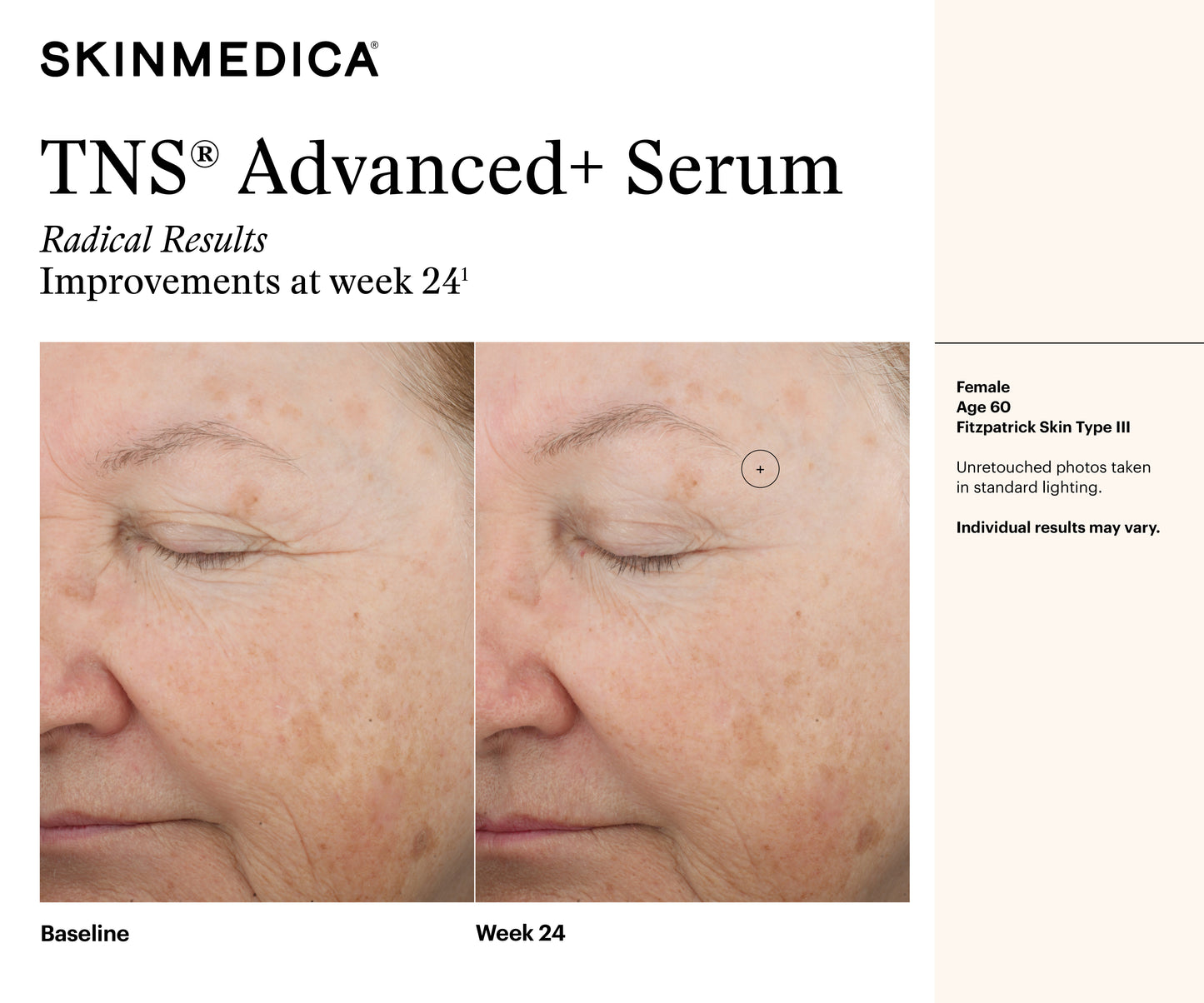 TNS Advanced+ Serum | SkinMedica