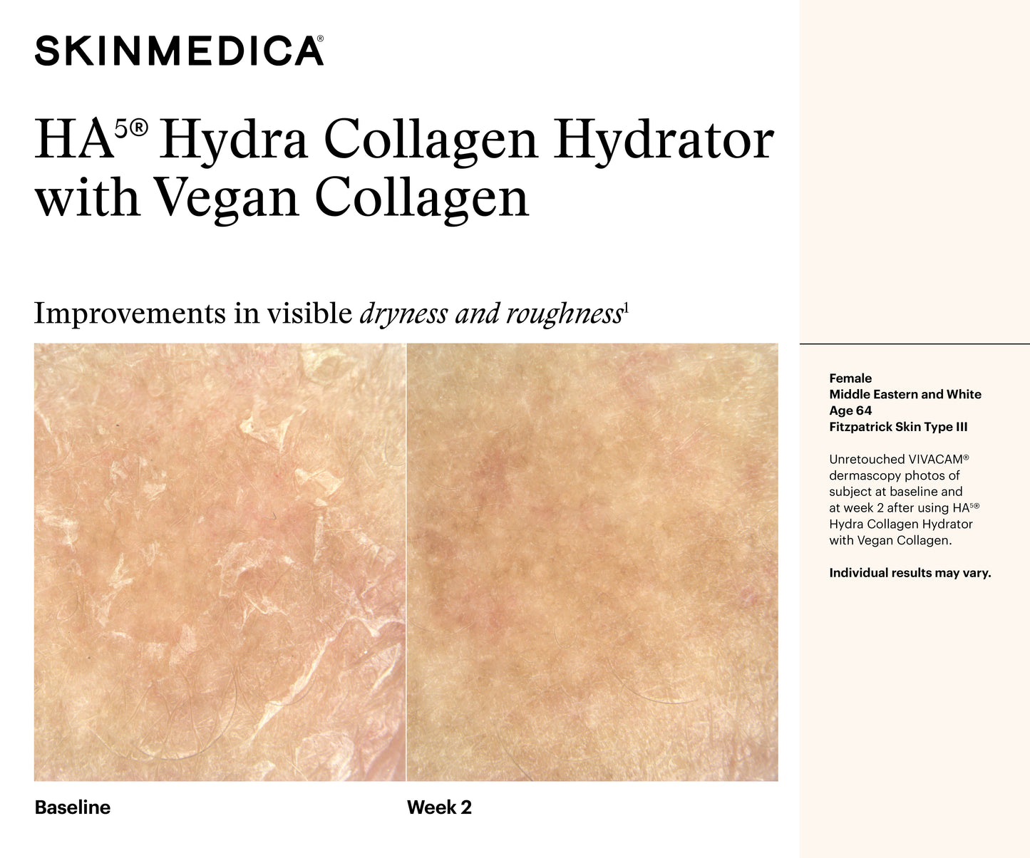 HA5 Hydra Collagen Hydrator with Vegan Collagen | SkinMedica
