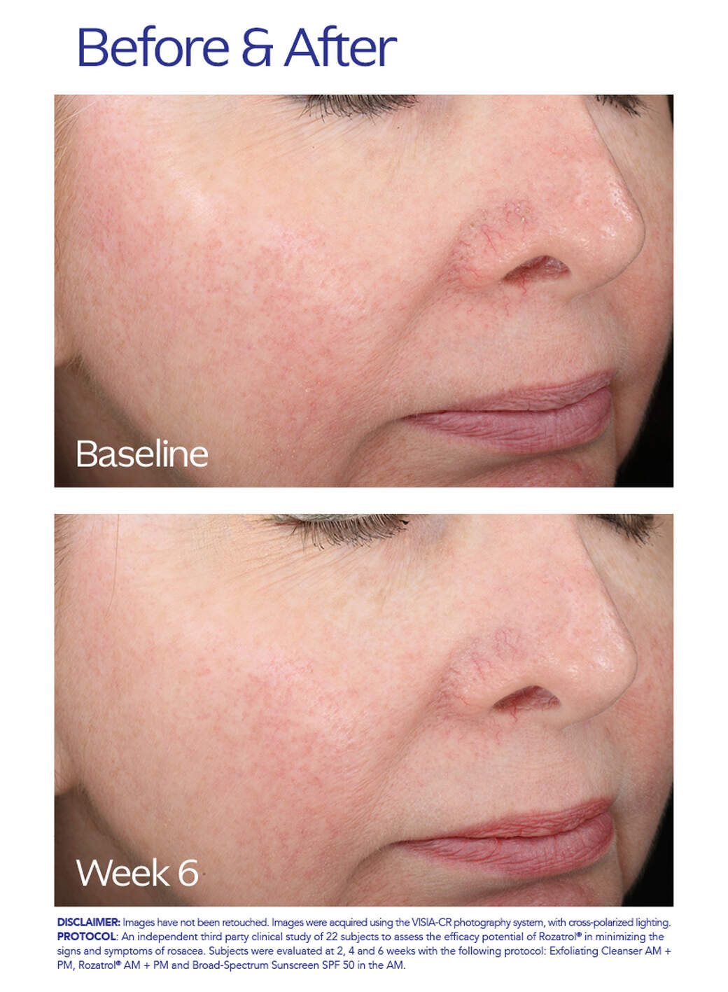 Rozatrol | ZO Skin Health