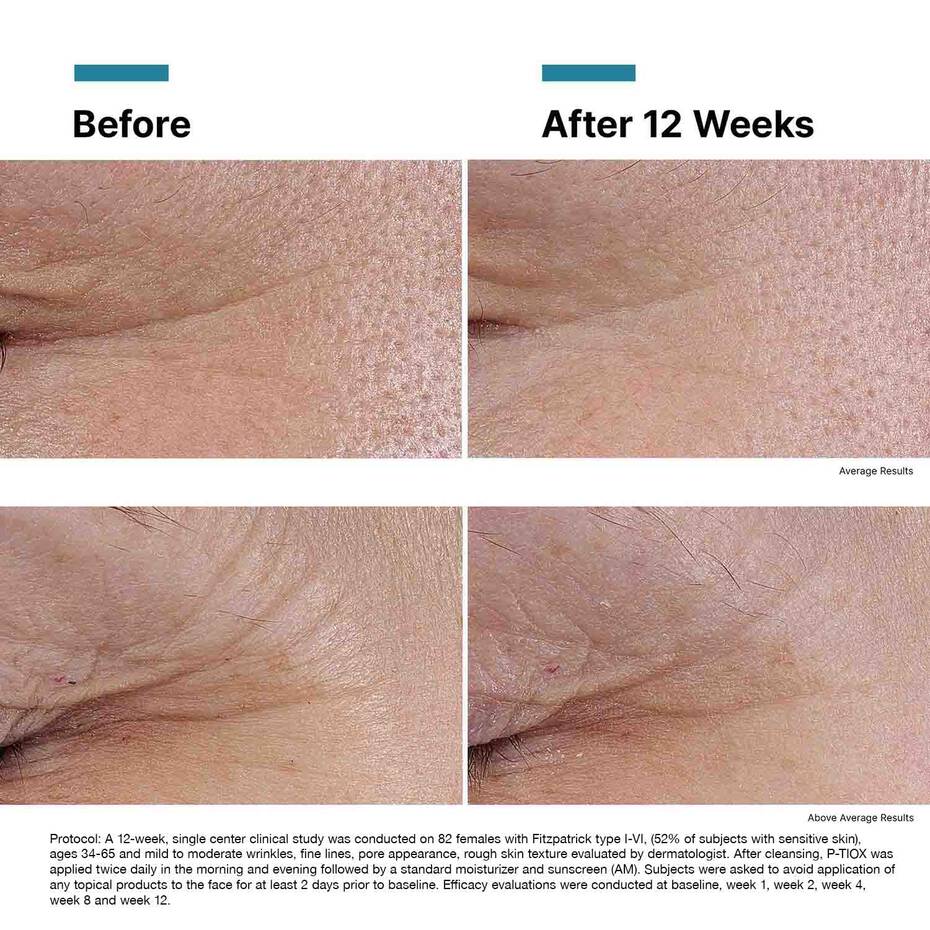 P-TIOX Anti-Wrinkle Serum | SkinCeuticals