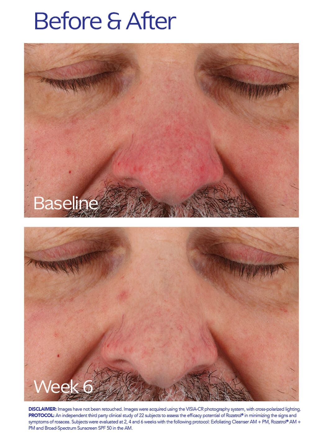 Rozatrol | ZO Skin Health